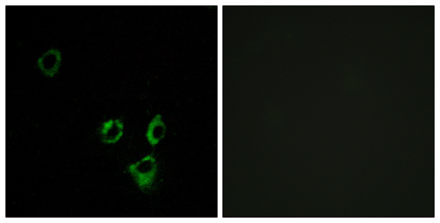 ICC/IF analysis of MCF7 cells using GTX87569 OR2T5 + OR2T29 antibody. The picture on the right is blocked with the synthesized peptide.