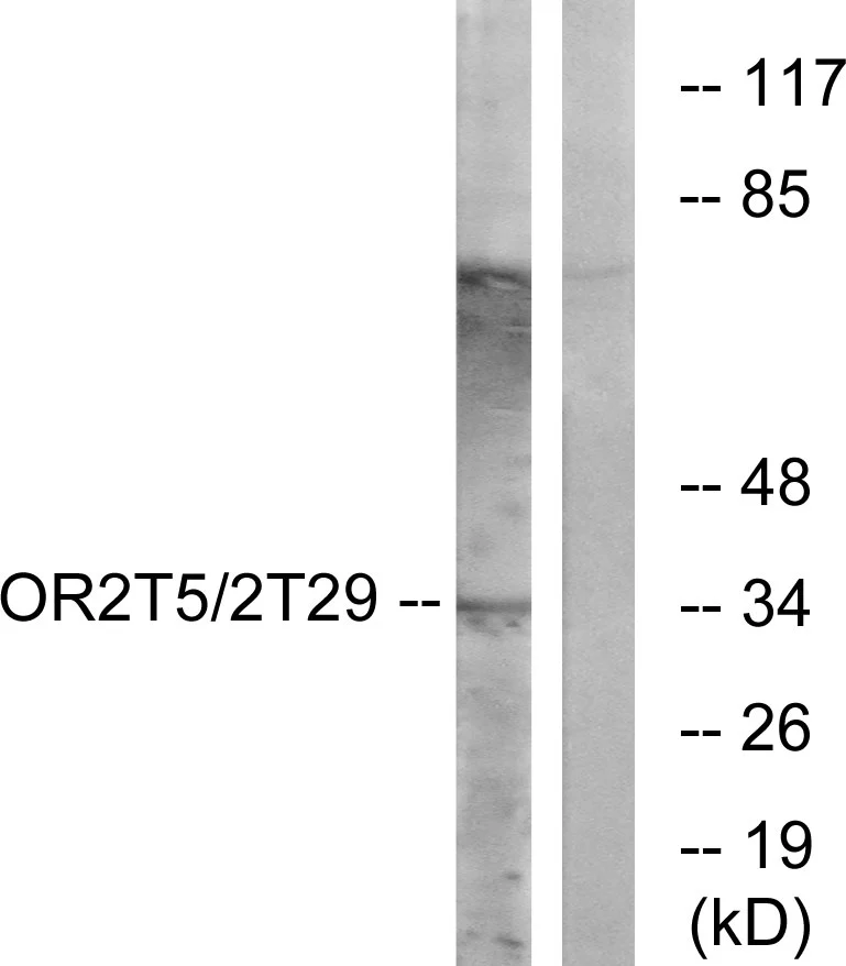 WB analysis of K562 cell lysates using GTX87569 OR2T5 + OR2T29 antibody. The lane on the right is blocked with the synthesized peptide.