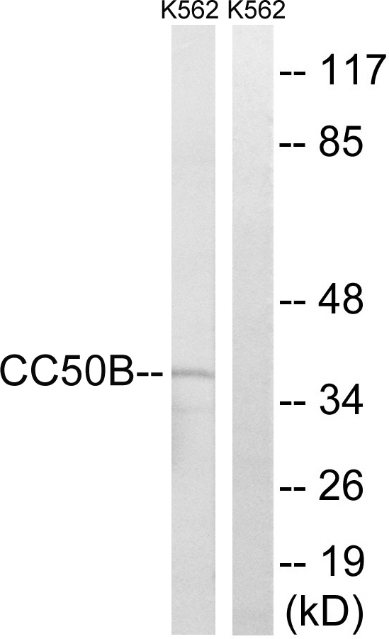 WB analysis of K562 cell lysates using GTX87573 TMEM30B antibody. The lane on the right is blocked with the synthesized peptide.