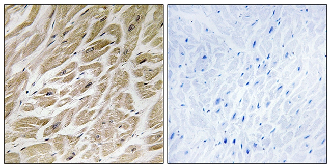 IHC-P analysis of human heart tissue using GTX87575 MRPS24 antibody. The picture on the right is blocked with the synthesized peptide. IHC-P analysis of human heart tissue using GTX87575 MRPS24 antibody. The picture on the right is blocked with the synthesized peptide.