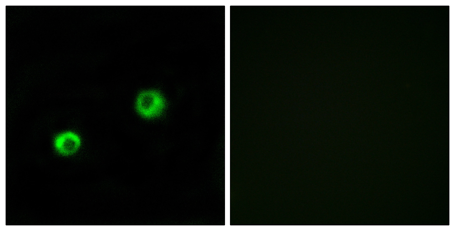ICC/IF analysis of MCF7 cells using GTX87576 ARSI antibody. The picture on the right is blocked with the synthesized peptide. ICC/IF analysis of MCF7 cells using GTX87576 ARSI antibody. The picture on the right is blocked with the synthesized peptide.
