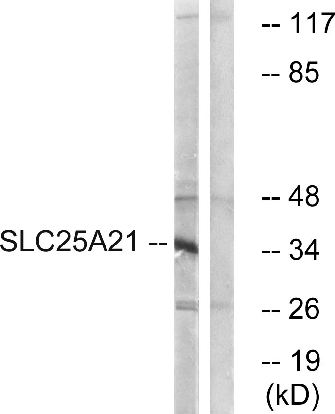 WB analysis of HepG2 cell lysates using GTX87583 SLC25A21 antibody. The lane on the right is blocked with the synthesized peptide.