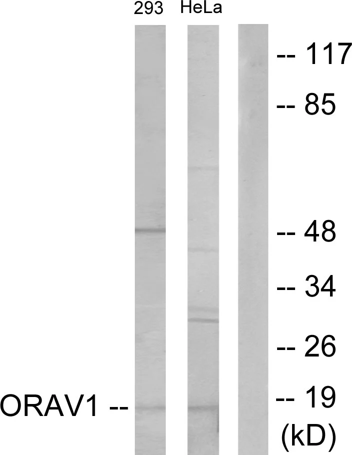 WB analysis of 293 and HeLa cell lysates using GTX87584 ORAV1 antibody. The lane on the right is blocked with the synthesized peptide. WB analysis of 293 and HeLa cell lysates using GTX87584 ORAV1 antibody. The lane on the right is blocked with the synthesized peptide.