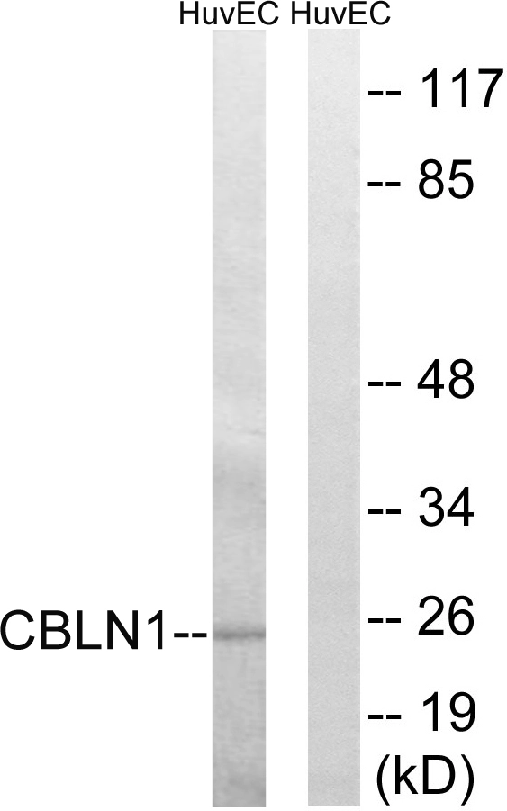 WB analysis of HUVEC cell lysates using GTX87593 CBLN1 antibody. The lane on the right is blocked with the synthesized peptide. WB analysis of HUVEC cell lysates using GTX87593 CBLN1 antibody. The lane on the right is blocked with the synthesized peptide.