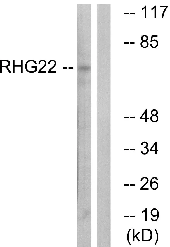 WB analysis of K562 cell lysates using GTX87597 ARHGAP22 antibody. The lane on the right is blocked with the synthesized peptide. WB analysis of K562 cell lysates using GTX87597 ARHGAP22 antibody. The lane on the right is blocked with the synthesized peptide.