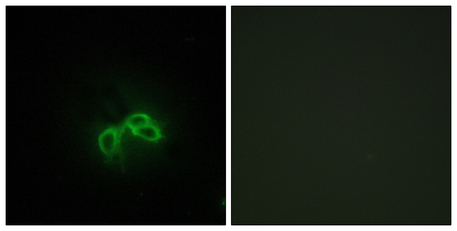 ICC/IF analysis of NIH3T3 cells using GTX87601 BLCAP antibody. The picture on the right is blocked with the synthesized peptide. ICC/IF analysis of NIH3T3 cells using GTX87601 BLCAP antibody. The picture on the right is blocked with the synthesized peptide.