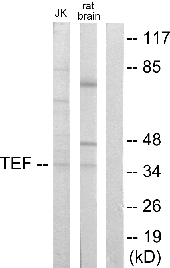 WB analysis of Jurkat and rat brain cell lysates using GTX87608 TEF antibody. The lane on the right is blocked with the synthesized peptide. WB analysis of Jurkat and rat brain cell lysates using GTX87608 TEF antibody. The lane on the right is blocked with the synthesized peptide.