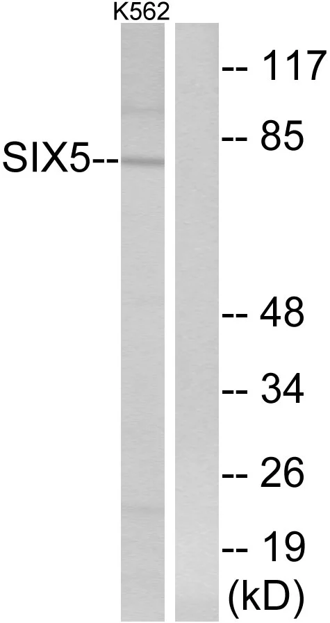 WB analysis of K562 cell lysates using GTX87610 SIX5 antibody. The lane on the right is blocked with the synthesized peptide. WB analysis of K562 cell lysates using GTX87610 SIX5 antibody. The lane on the right is blocked with the synthesized peptide.