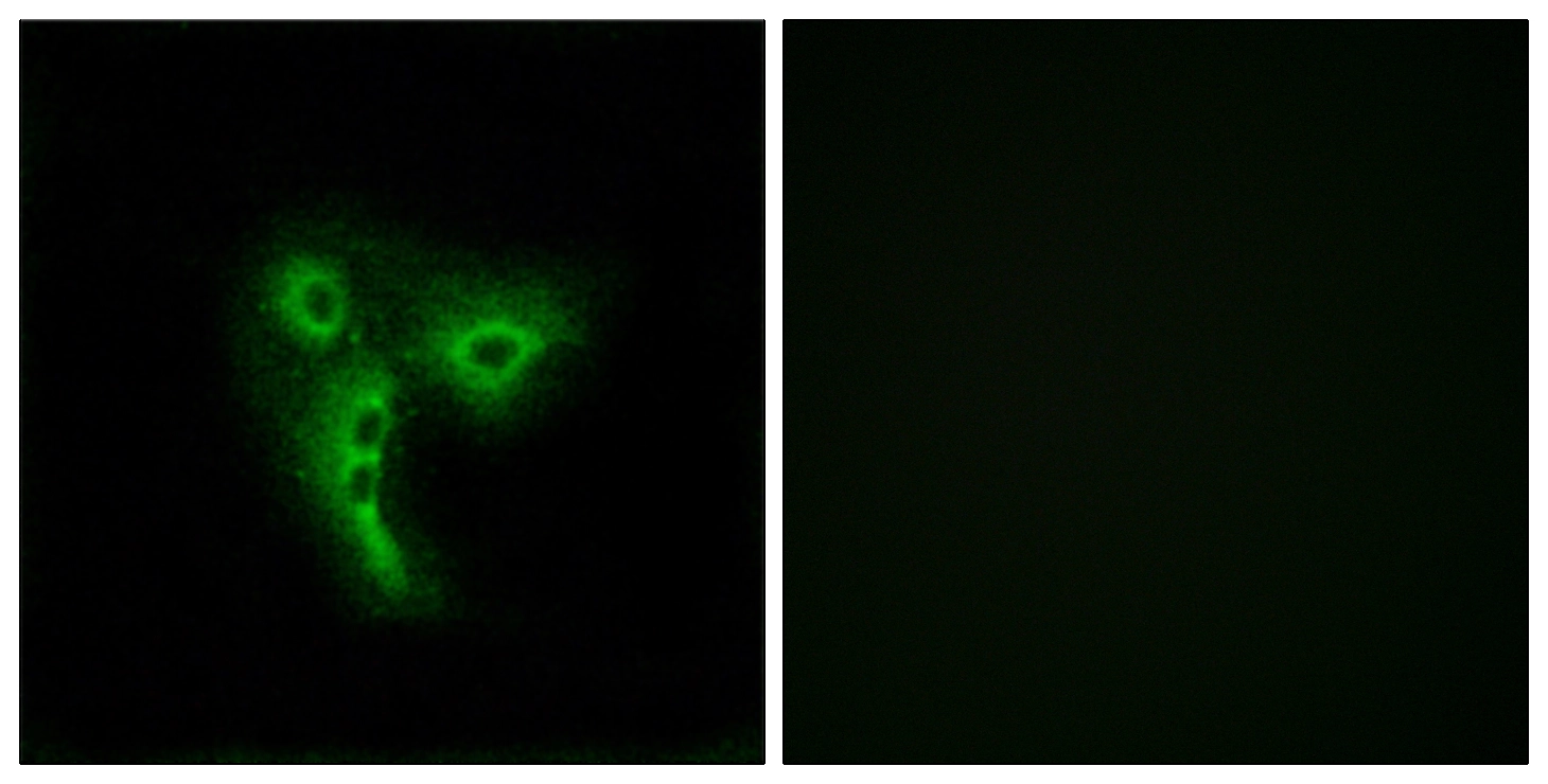 ICC/IF analysis of A549 cells using GTX87617 OR4A4 + OR4A47 antibody. The picture on the right is blocked with the synthesized peptide. ICC/IF analysis of A549 cells using GTX87617 OR4A4 + OR4A47 antibody. The picture on the right is blocked with the synthesized peptide.