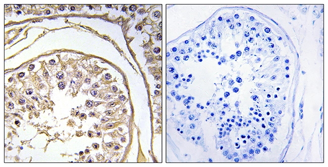 IHC-P analysis of human testis tissue using GTX87618 BAGE2 antibody. The picture on the right is blocked with the synthesized peptide. IHC-P analysis of human testis tissue using GTX87618 BAGE2 antibody. The picture on the right is blocked with the synthesized peptide.
