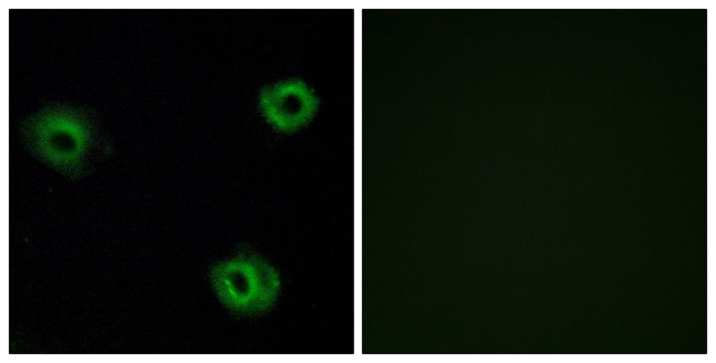 ICC/IF analysis of A549 cells using GTX87621 NTSR2 antibody. The picture on the right is blocked with the synthesized peptide. ICC/IF analysis of A549 cells using GTX87621 NTSR2 antibody. The picture on the right is blocked with the synthesized peptide.