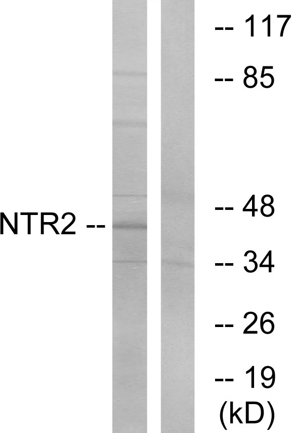 WB analysis of Jurkat cell lysates using GTX87621 NTSR2 antibody. The lane on the right is blocked with the synthesized peptide.