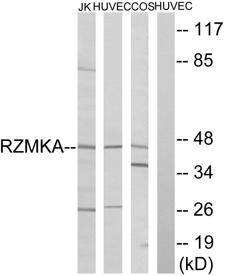 WB analysis of HUVEC,COS,and Jurkat cell lysates using GTX87628 RIMKA antibody. The lane on the right is blocked with the synthesized peptide.