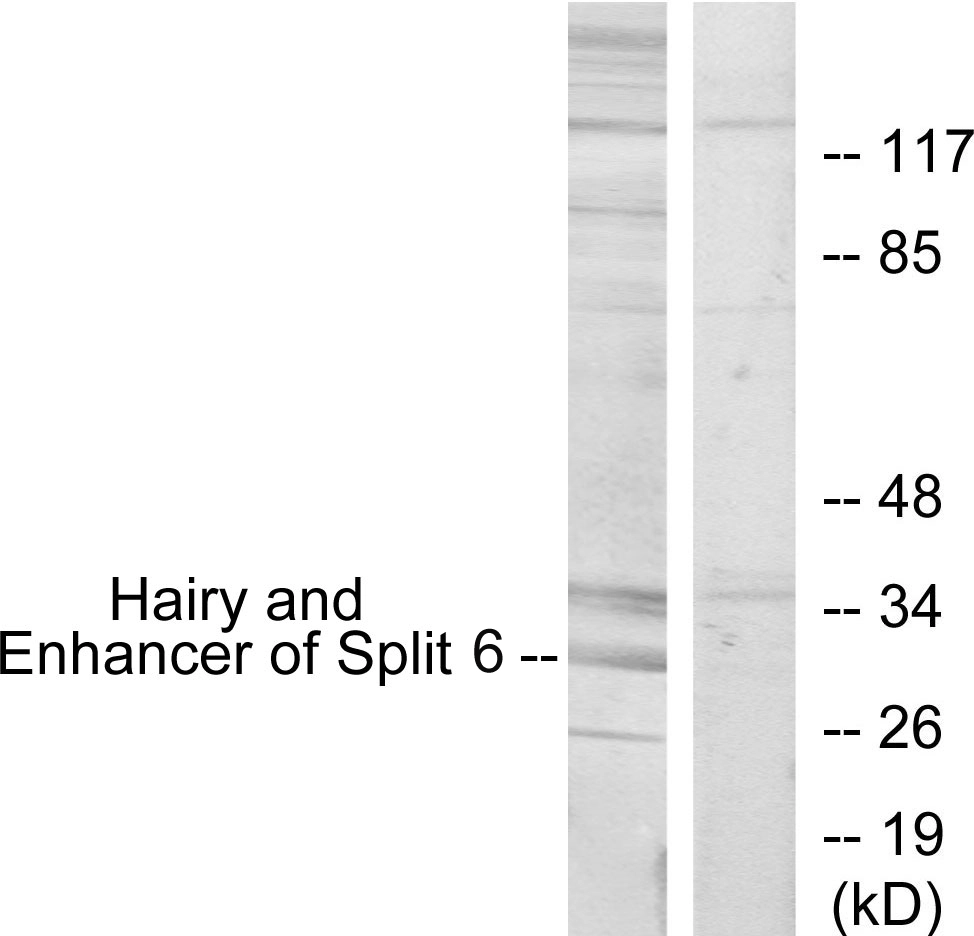 WB analysis of HeLa cell lysates using GTX87637 HES6 antibody. The lane on the right is blocked with the synthesized peptide. WB analysis of HeLa cell lysates using GTX87637 HES6 antibody. The lane on the right is blocked with the synthesized peptide.