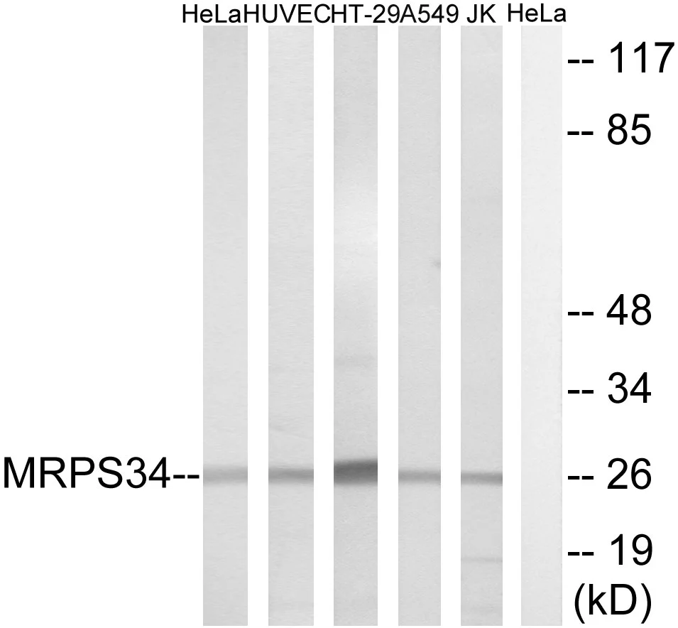 WB analysis of HeLa, HUVEC, HT-29, A549, and Jurkat cell lysates using GTX87642 MRPS34 antibody. The lane on the right is blocked with the synthesized peptide. WB analysis of HeLa, HUVEC, HT-29, A549, and Jurkat cell lysates using GTX87642 MRPS34 antibody. The lane on the right is blocked with the synthesized peptide.