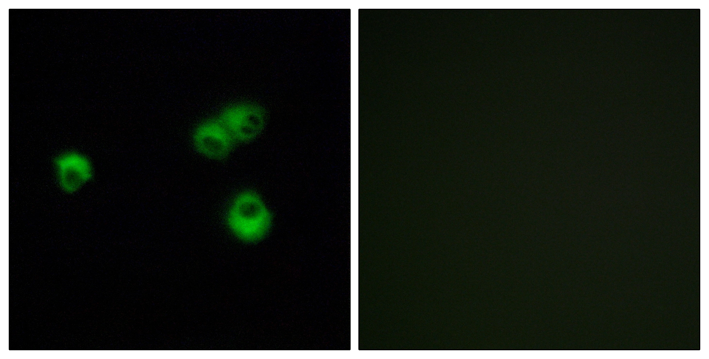 ICC/IF analysis of MCF7 cells using GTX87643 OR7E5P antibody. The picture on the right is blocked with the synthesized peptide. ICC/IF analysis of MCF7 cells using GTX87643 OR7E5P antibody. The picture on the right is blocked with the synthesized peptide.