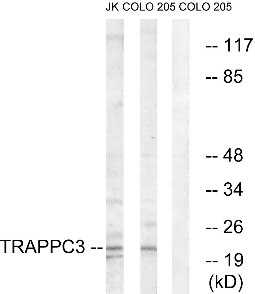 WB analysis of COLO and Jurkat cell lysates using GTX87644 TRAPPC3 antibody. The lane on the right is blocked with the synthesized peptide. WB analysis of COLO and Jurkat cell lysates using GTX87644 TRAPPC3 antibody. The lane on the right is blocked with the synthesized peptide.