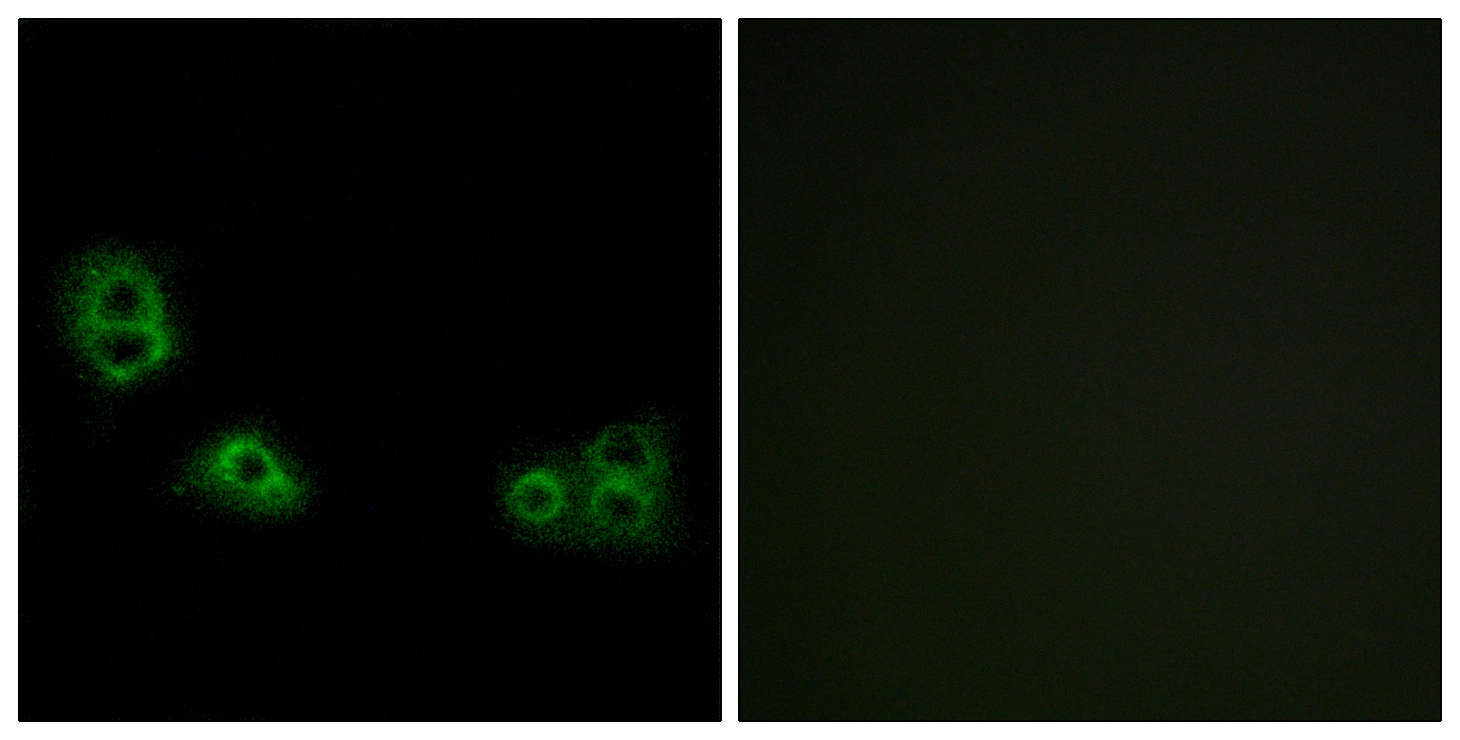 ICC/IF analysis of MCF7 cells using GTX87650 TMEM185A antibody. The picture on the right is blocked with the synthesized peptide. ICC/IF analysis of MCF7 cells using GTX87650 TMEM185A antibody. The picture on the right is blocked with the synthesized peptide.