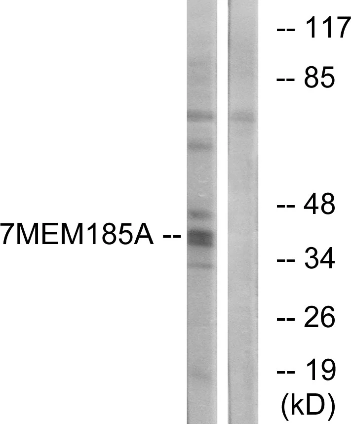 WB analysis of K562 cell lysates using GTX87650 TMEM185A antibody. The lane on the right is blocked with the synthesized peptide.