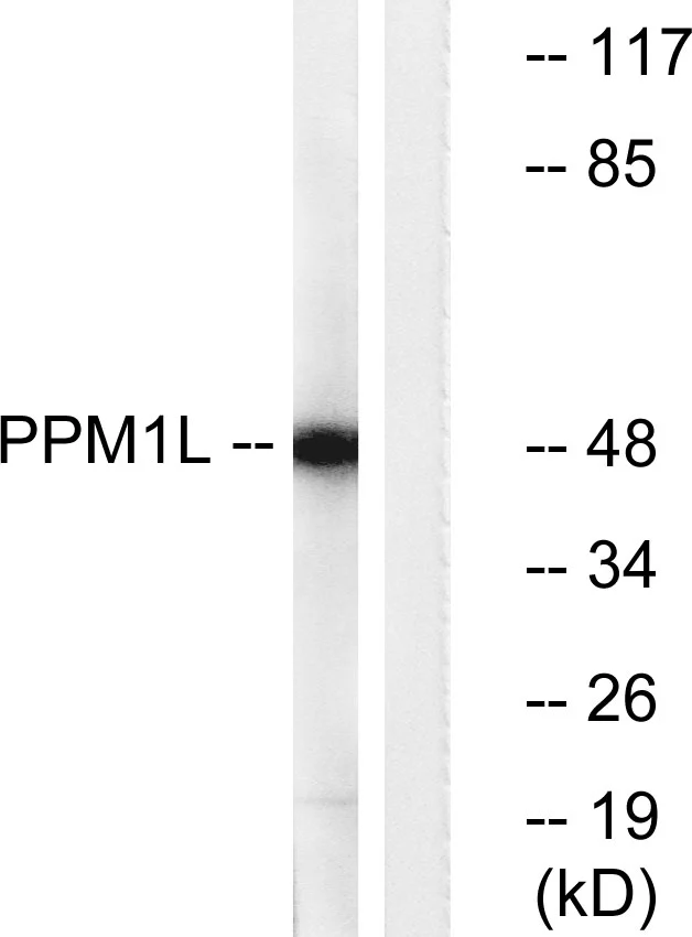 WB analysis of Jurkat cell lysates using GTX87651 PPM1L antibody. The lane on the right is blocked with the synthesized peptide. WB analysis of Jurkat cell lysates using GTX87651 PPM1L antibody. The lane on the right is blocked with the synthesized peptide.