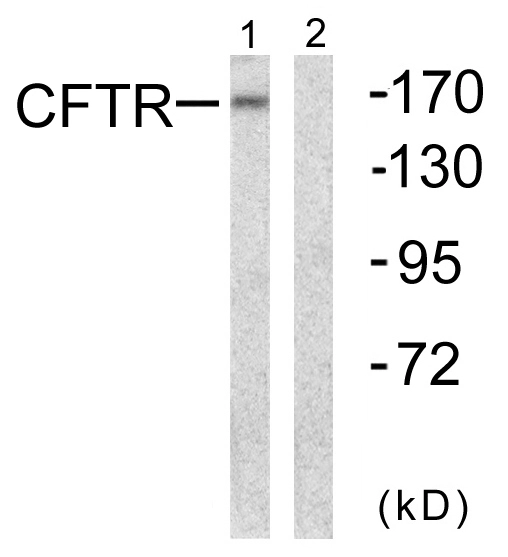 WB analysis of NIH/3T3 cell lysates using GTX87672 CFTR antibody. The lane on the right is blocked with the synthesized peptide.