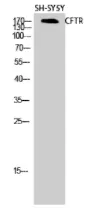 WB analysis of SH-SY5Y cell lysates using GTX87672 CFTR antibody. Dilution : 1:2000