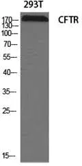 WB analysis of 293T cell lysate using GTX87672 CFTR antibody. Dilution : 1:2000