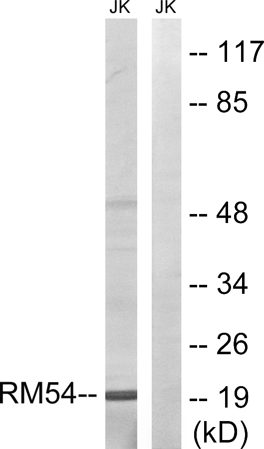 WB analysis of Jurkat cell lysates using GTX87675 MRPL54 antibody. The lane on the right is blocked with the synthesized peptide.