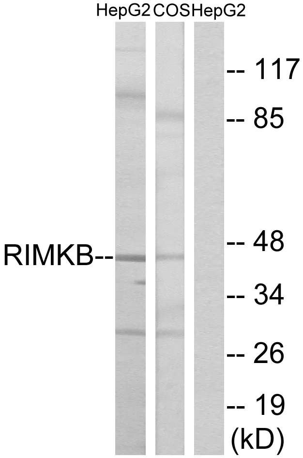 WB analysis of HepG2 and COS cell lysates using GTX87679 RIMKB antibody. The lane on the right is blocked with the synthesized peptide.