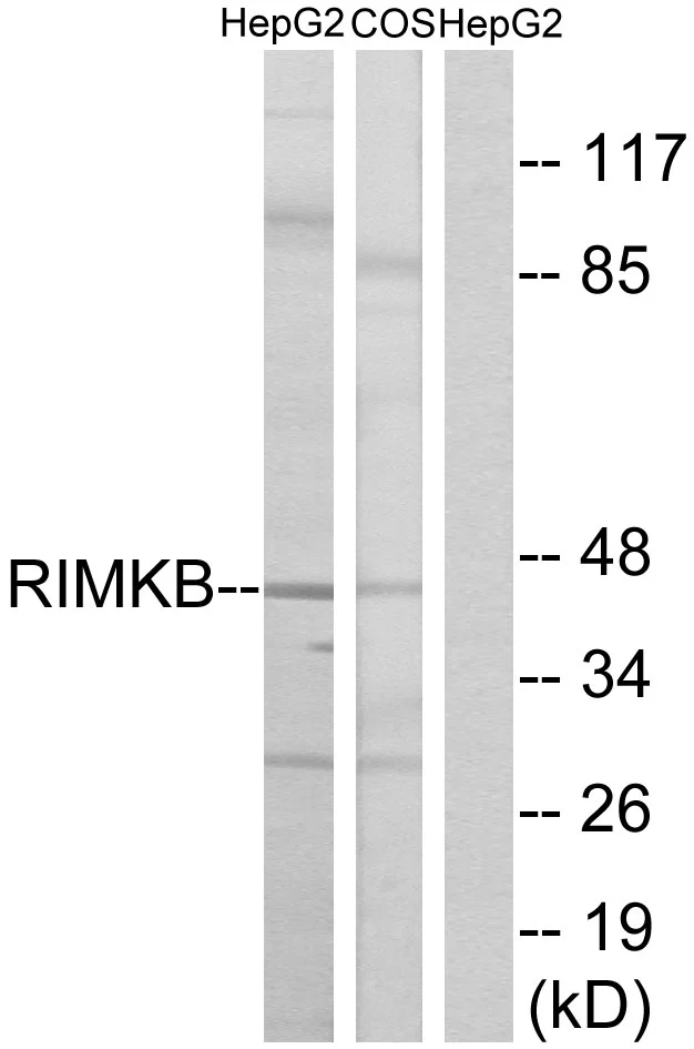 WB analysis of HepG2 and COS cell lysates using GTX87679 RIMKB antibody. The lane on the right is blocked with the synthesized peptide. WB analysis of HepG2 and COS cell lysates using GTX87679 RIMKB antibody. The lane on the right is blocked with the synthesized peptide.