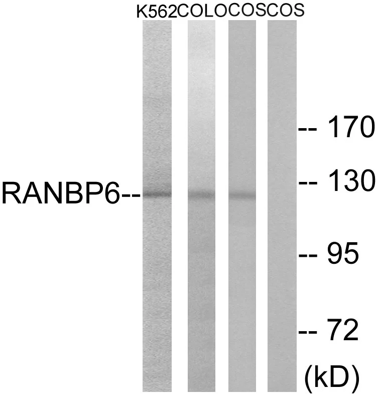 WB analysis of COS7, K562, and COLO cell lysates using GTX87686 RANBP6 antibody. The lane on the right is blocked with the synthesized peptide. WB analysis of COS7, K562, and COLO cell lysates using GTX87686 RANBP6 antibody. The lane on the right is blocked with the synthesized peptide.