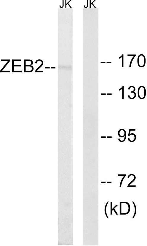 WB analysis of Jurkat cell lysates using GTX87688 ZEB2 antibody. The lane on the right is blocked with the synthesized peptide.