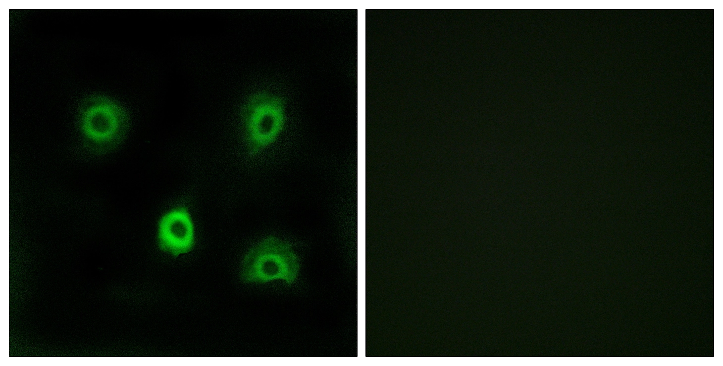 ICC/IF analysis of A549 cells using GTX87697 ABHD6 antibody. The picture on the right is blocked with the synthesized peptide. ICC/IF analysis of A549 cells using GTX87697 ABHD6 antibody. The picture on the right is blocked with the synthesized peptide.