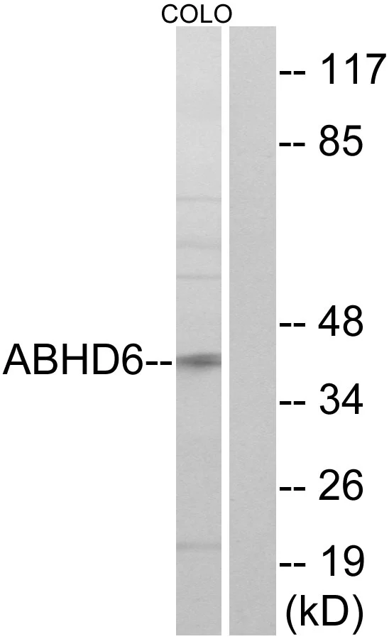 WB analysis of COLO cell lysates using GTX87697 ABHD6 antibody. The lane on the right is blocked with the synthesized peptide.