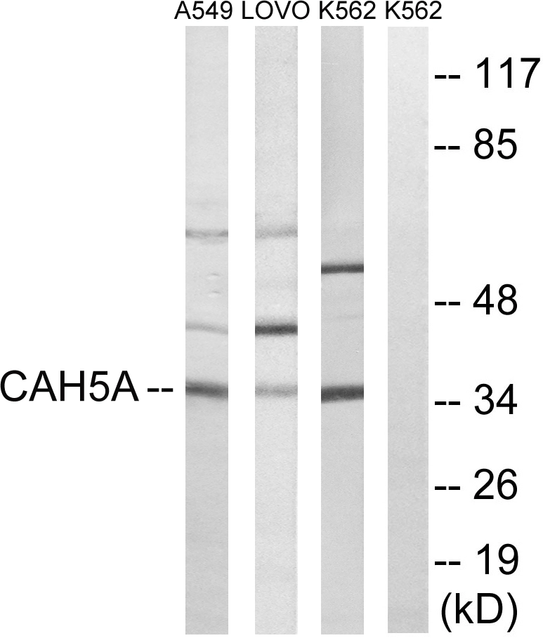 WB analysis of A549, LOVO, and K562 cell lysates using GTX87702 CA5A antibody. The lane on the right is blocked with the synthesized peptide. WB analysis of A549, LOVO, and K562 cell lysates using GTX87702 CA5A antibody. The lane on the right is blocked with the synthesized peptide.
