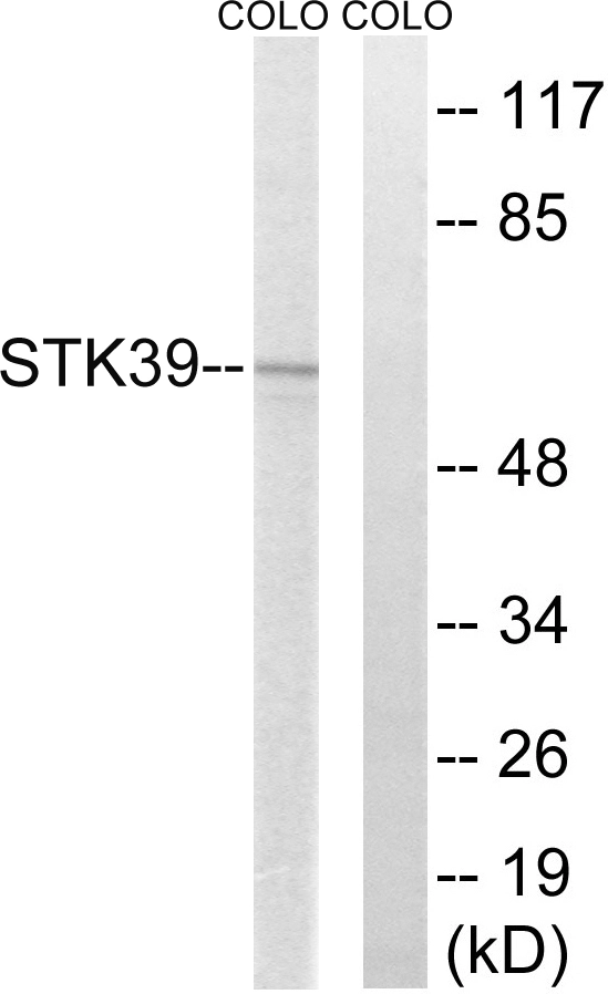WB analysis of COLO205 cell lysates using GTX87705 STK39 antibody. The lane on the right is blocked with the synthesized peptide. WB analysis of COLO205 cell lysates using GTX87705 STK39 antibody. The lane on the right is blocked with the synthesized peptide.