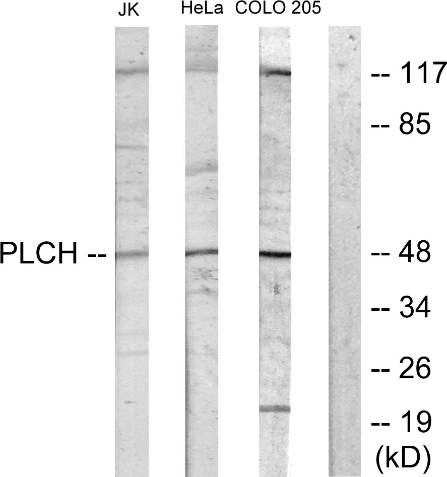 WB analysis of Jurkat cell,COLO205 cell,HeLa cell,and HUVEC cell lysates using GTX87708 GPAT3 antibody. The lane on the right is blocked with the synthesized peptide.