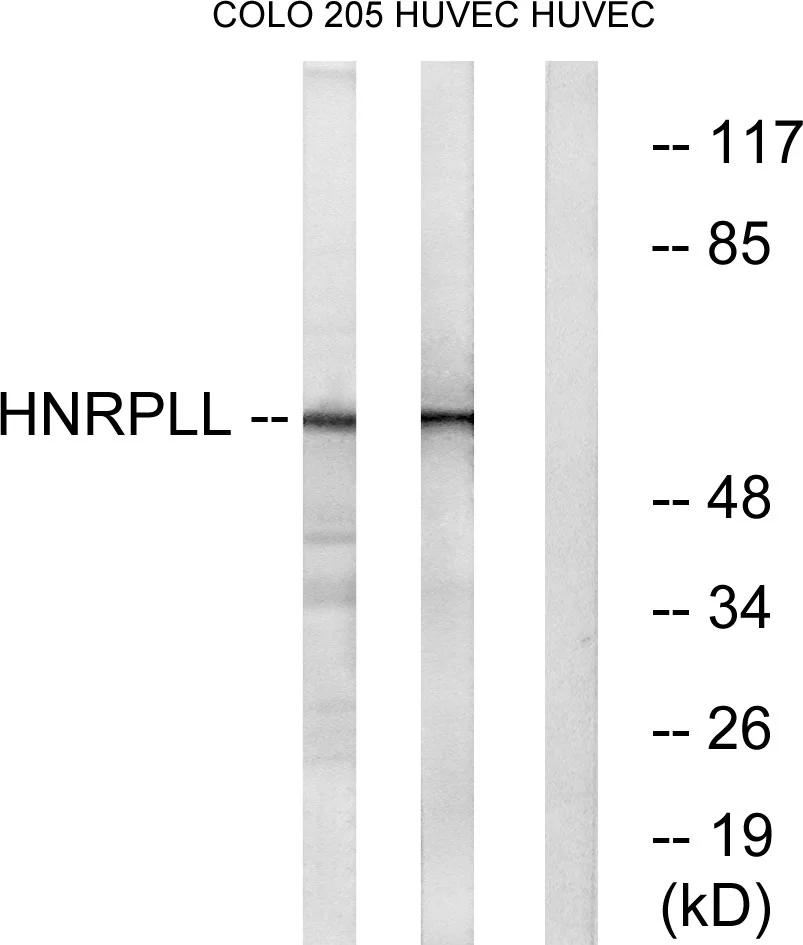 WB analysis of HUVEC and COLO cell lysates using GTX87711 HNRPLL antibody. The lane on the right is blocked with the synthesized peptide. WB analysis of HUVEC and COLO cell lysates using GTX87711 HNRPLL antibody. The lane on the right is blocked with the synthesized peptide.