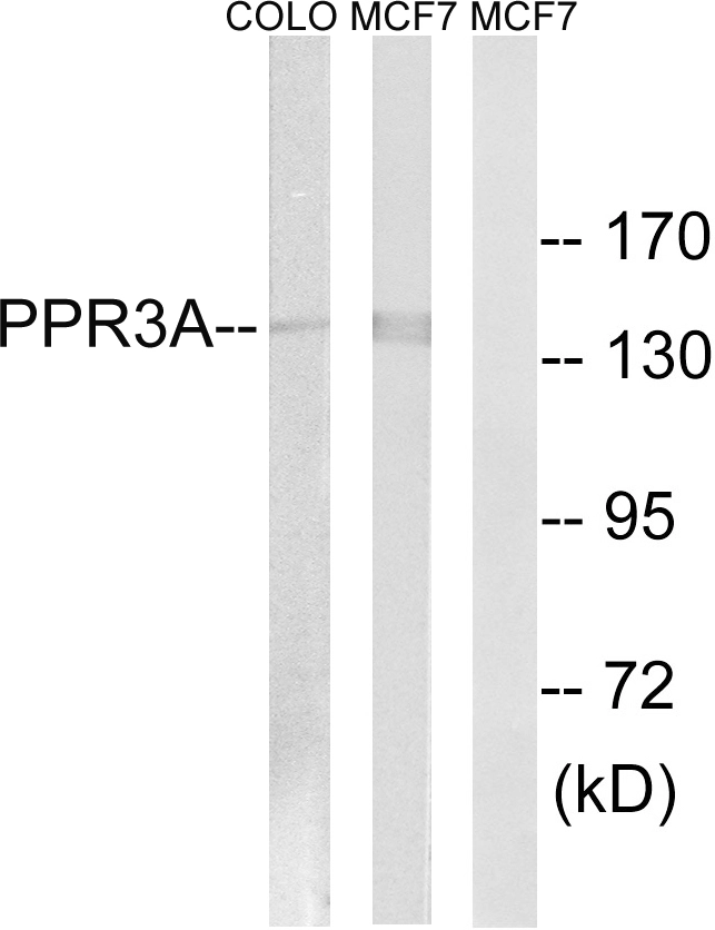 WB analysis of MCF-7 and COLO cell lysates using GTX87725 PPP1R3A antibody. The lane on the right is blocked with the synthesized peptide. WB analysis of MCF-7 and COLO cell lysates using GTX87725 PPP1R3A antibody. The lane on the right is blocked with the synthesized peptide.