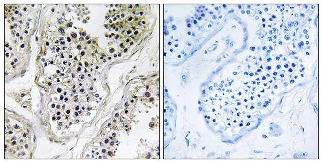 IHC-P analysis of human testis tissue using GTX87736 ATXN7L1 antibody. The picture on the right is blocked with the synthesized peptide. IHC-P analysis of human testis tissue using GTX87736 ATXN7L1 antibody. The picture on the right is blocked with the synthesized peptide.