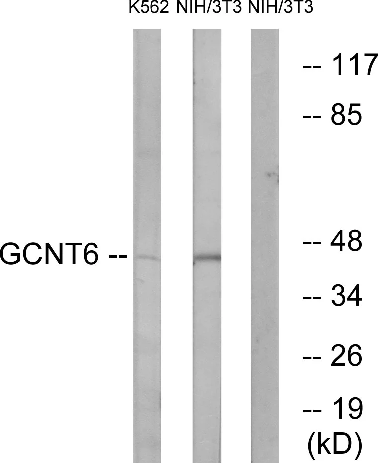 WB analysis of NIH/3T3 and K562 cell lysates using GTX87743 GCNT6 antibody. The lane on the right is blocked with the synthesized peptide. WB analysis of NIH/3T3 and K562 cell lysates using GTX87743 GCNT6 antibody. The lane on the right is blocked with the synthesized peptide.