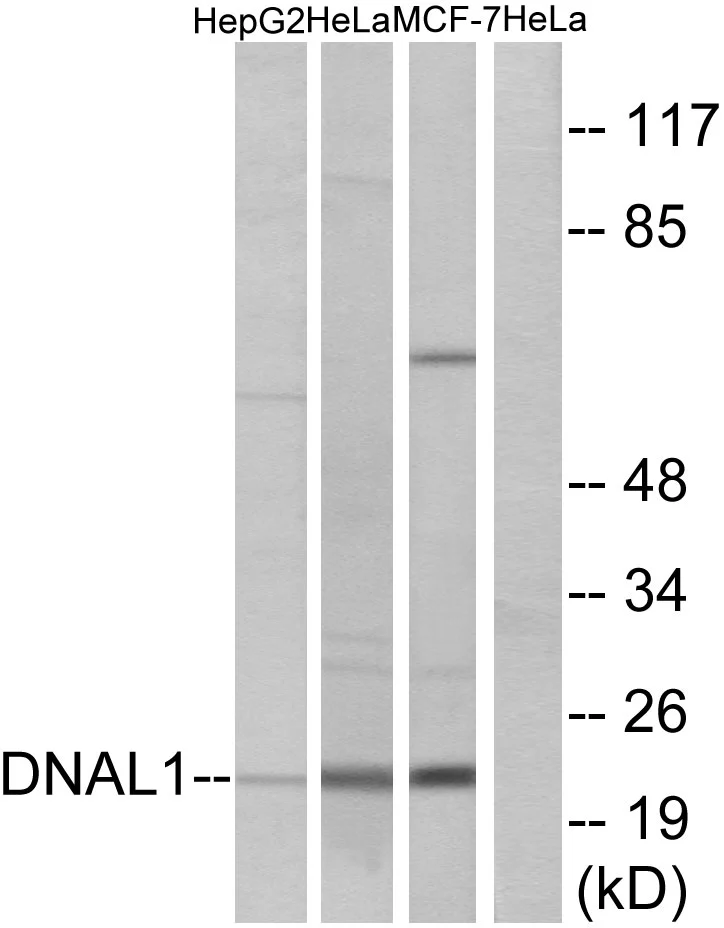 WB analysis of HeLa, HepG2, and MCF-7 cell lysates using GTX87750 DNAL1 antibody. The lane on the right is blocked with the synthesized peptide.