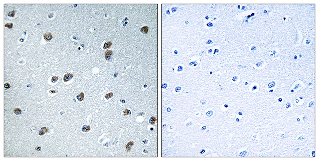 IHC-P analysis of human brain tissue using GTX87752 KLHL29 antibody. The picture on the right is blocked with the synthesized peptide. IHC-P analysis of human brain tissue using GTX87752 KLHL29 antibody. The picture on the right is blocked with the synthesized peptide.