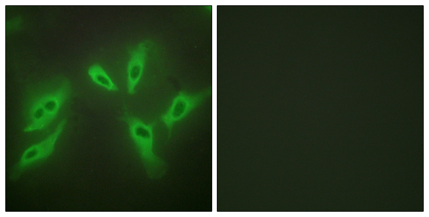 ICC/IF analysis of HeLa cells using GTX87753 TUSC3 antibody. The picture on the right is blocked with the synthesized peptide. ICC/IF analysis of HeLa cells using GTX87753 TUSC3 antibody. The picture on the right is blocked with the synthesized peptide.