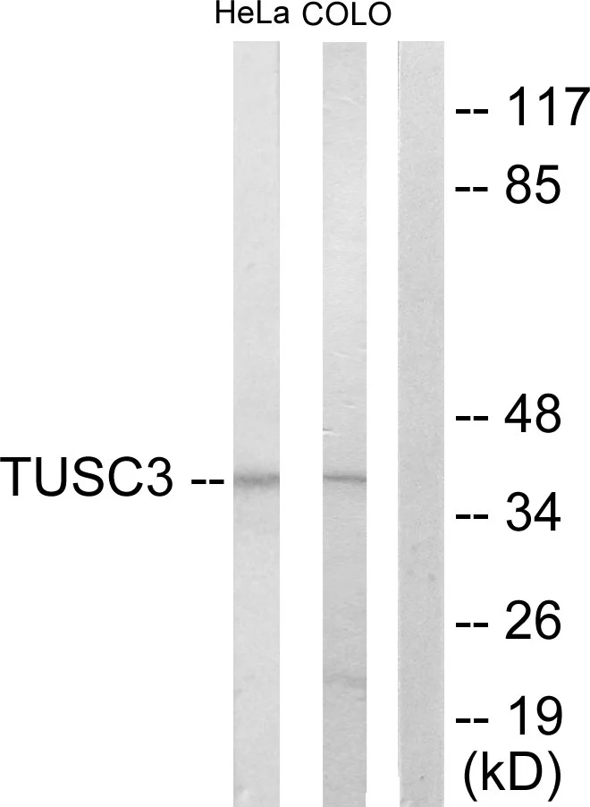 WB analysis of COLO205 and HeLa cell lysates using GTX87753 TUSC3 antibody. The lane on the right is blocked with the synthesized peptide.