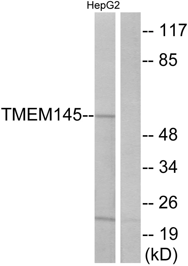 WB analysis of HepG2 cell lysates using GTX87759 TMEM145 antibody. The lane on the right is blocked with the synthesized peptide. WB analysis of HepG2 cell lysates using GTX87759 TMEM145 antibody. The lane on the right is blocked with the synthesized peptide.