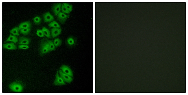 ICC/IF analysis of A549 cells using GTX87760 GPR180 antibody. The picture on the right is blocked with the synthesized peptide. ICC/IF analysis of A549 cells using GTX87760 GPR180 antibody. The picture on the right is blocked with the synthesized peptide.