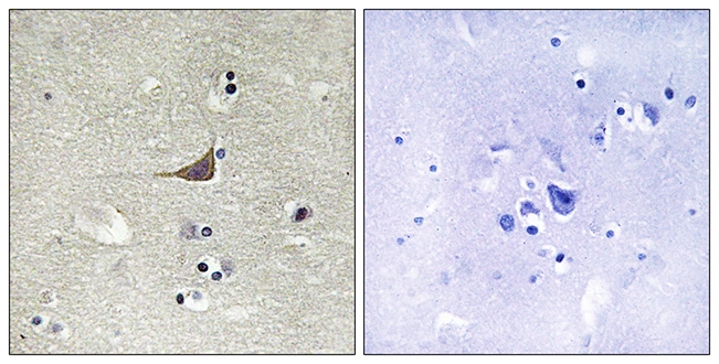 IHC-P analysis of human brain tissue using GTX87760 GPR180 antibody. The picture on the right is blocked with the synthesized peptide.