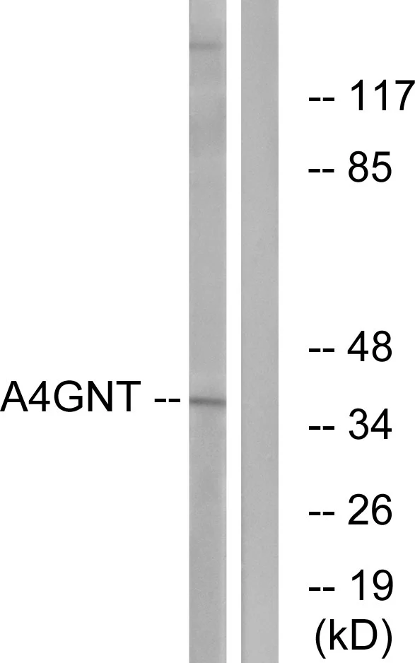 WB analysis of K562 cell lysates using GTX87765 A4GNT antibody. The lane on the right is blocked with the synthesized peptide. WB analysis of K562 cell lysates using GTX87765 A4GNT antibody. The lane on the right is blocked with the synthesized peptide.