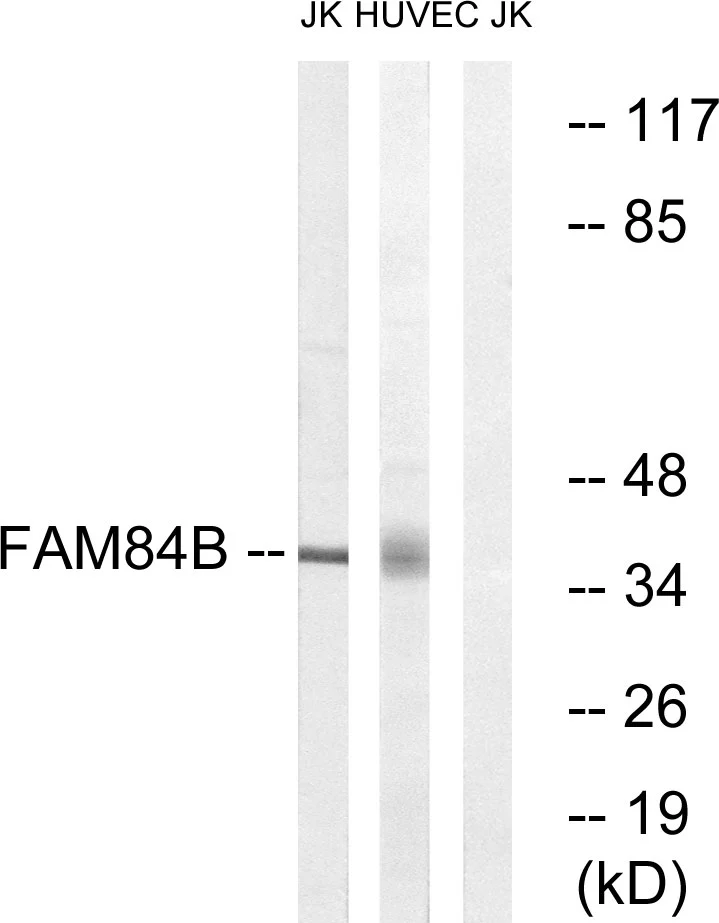 WB analysis of Jurkat and HUVEC cell lysates using GTX87774 FAM84B antibody. The lane on the right is blocked with the synthesized peptide. WB analysis of Jurkat and HUVEC cell lysates using GTX87774 FAM84B antibody. The lane on the right is blocked with the synthesized peptide.